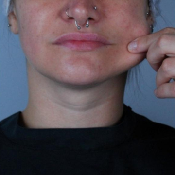 Antes